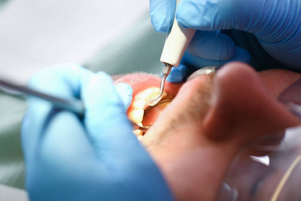 Best After-Hours Dental Trauma Care in Andover, MN